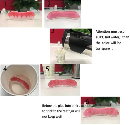 Carillas Dentales de Silicona Premium para Dientes Superiores e Inferiores - Image 2