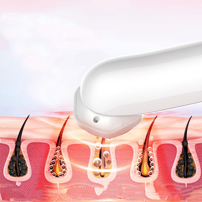 Instrumento de Belleza Facial RF con Iones - Rejuvenecimiento en Casa - Image 2