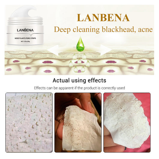 Mascarilla Nasal Limpiadora de Puntos Negros - 60 Láminas Potentes para Zona T - Image 8