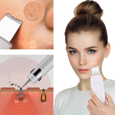 Limpiador Ultrasónico de Poros con Tecnología Peeling - Image 5