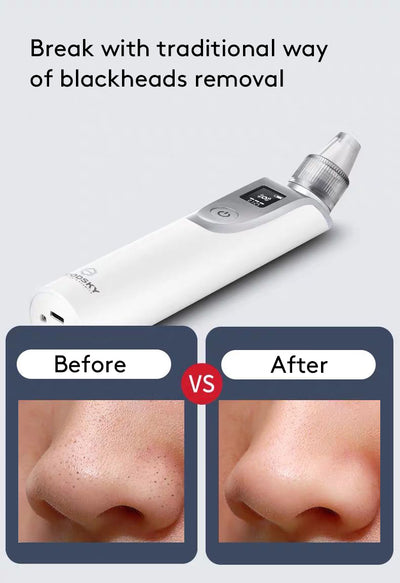 Extractor de Puntos Negros Facial Profesional - Image 11