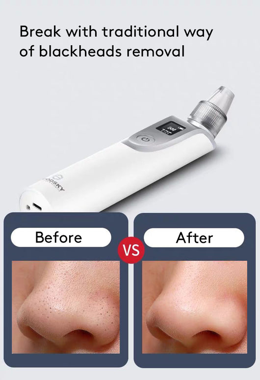 Extractor de Puntos Negros Facial Profesional - Image 11