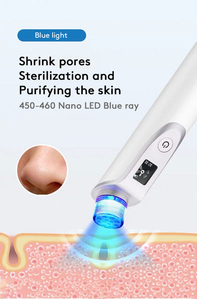 Extractor de Puntos Negros Facial Profesional - Image 10