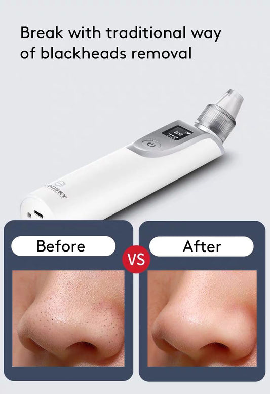 Extractor de Puntos Negros Facial Profesional - Image 2