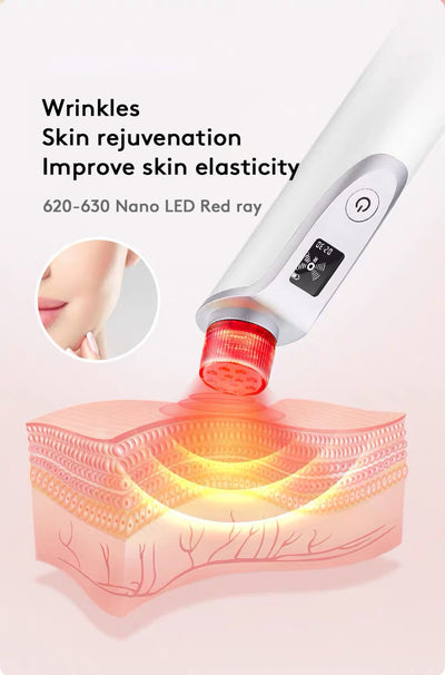 Extractor de Puntos Negros Facial Profesional - Image 13