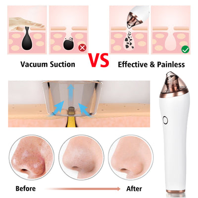 Dispositivo 4 en 1 de Limpieza Facial: Gua Sha, Succión, Extractor de Puntos Negros y Poros Profundos - Image 14