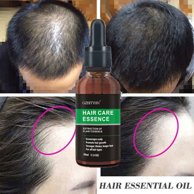 Aceite Esencial para Crecimiento del Cabello - Image 6