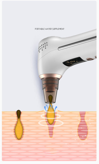 Limpiador Facial Eléctrico Anti-Acné y Puntos Negros con Tecnología Térmica - Image 4