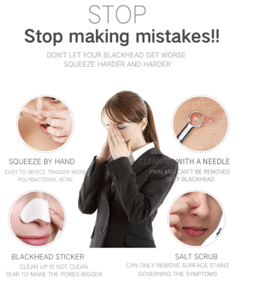 Dispositivo de Succión Facial para Eliminar Puntos Negros y Limpiar Poros - Image 4