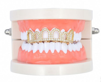 Set de Dientes de Oro con Diamantes Europeos - Carillas Dentales de Lujo Negro y Dorado - Image 4