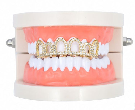 Set de Dientes de Oro con Diamantes Europeos - Carillas Dentales de Lujo Negro y Dorado - Image 4