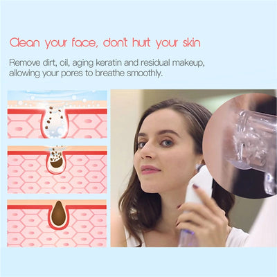 Limpiador Facial Ultrasónico Extractor de Puntos Negros y Acné - Image 14