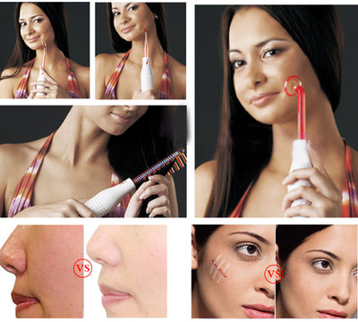 Lámpara de Electroterapia 4 en 1 - Eliminador de Acné y Rejuvenecimiento Facial - Image 13