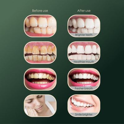 Raspador Dental Profesional para el Hogar - Image 10