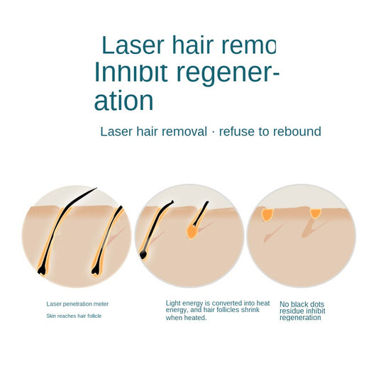 Depilador Láser IPL Portátil - Sistema Permanente de Eliminación de Vello Corporal - Image 3