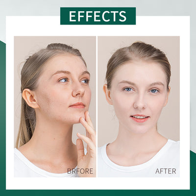 Mascarilla de Gel Centella Asiática Lycome - Hidratación Nocturna Intensiva - Image 2