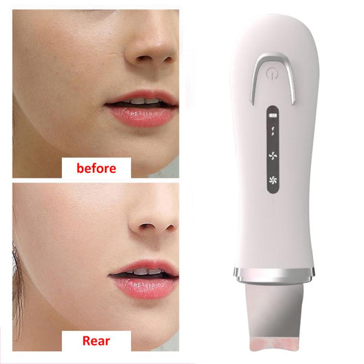 Limpiador Eléctrico de Poros Facial - Image 7