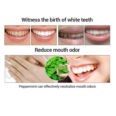 Removedor de Sarro Dental Profesional - Image 14