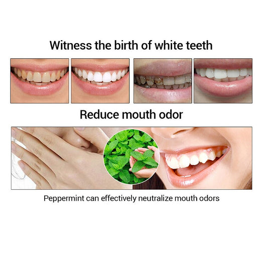 Removedor de Sarro Dental Profesional - Image 14