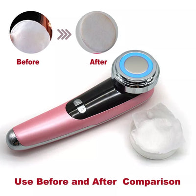 White facial massage importer with red and blue LED light ring, two 'POLYPEPTIDE' facial mask boxes, and a pink cat ear headband. - Image 9