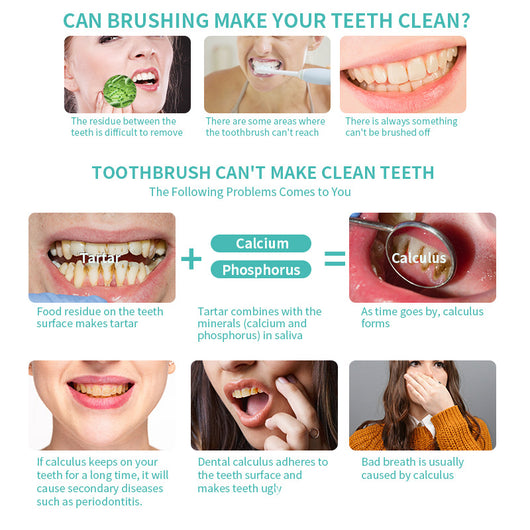 Black electric dental scaler kit with LED screen, dental pick, mirror, polishing head, and USB cable for home use. - Image 15
