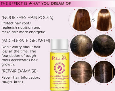 Aceite Esencial Tratamiento Líquido para el Crecimiento del Cabello - Prevención de Caída 20ml - Image 13