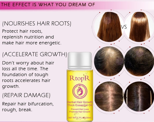 Aceite Esencial Tratamiento Líquido para el Crecimiento del Cabello - Prevención de Caída 20ml - Image 13