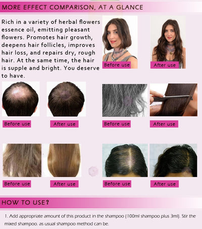 Aceite Esencial Tratamiento Líquido para el Crecimiento del Cabello - Prevención de Caída 20ml - Image 14
