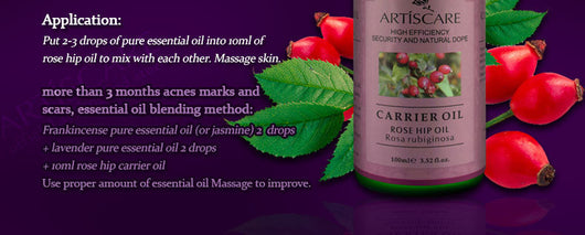 Aceite Esencial de Lavanda ARTISCARE - Image 19