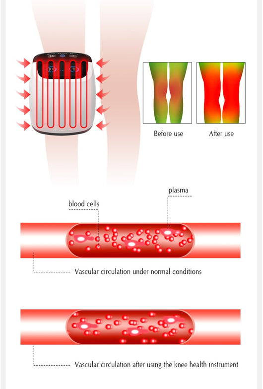 Masajeador Inteligente de Rodilla con Tecnología de Calor - Image 12