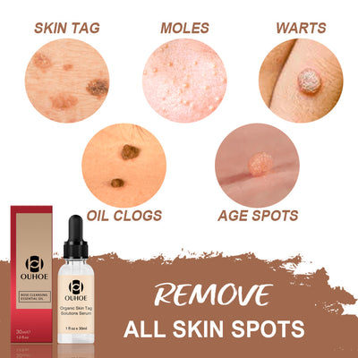 Loción Reparadora Antimanchas con Aceite de Rosa - Eliminador de Lunares y Manchas Oscuras - Image 8