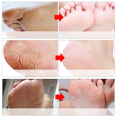 Mascarilla Regeneradora para Pies con Efecto Blanqueador e Hidratante - Image 28
