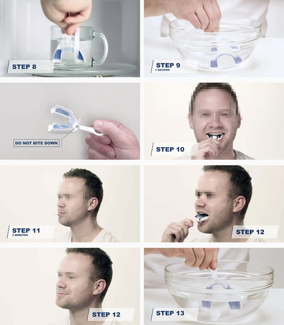 Protector Nocturno para Bruxismo - Férula Dental Cómoda - Image 10