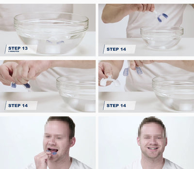 Protector Nocturno para Bruxismo - Férula Dental Cómoda - Image 11
