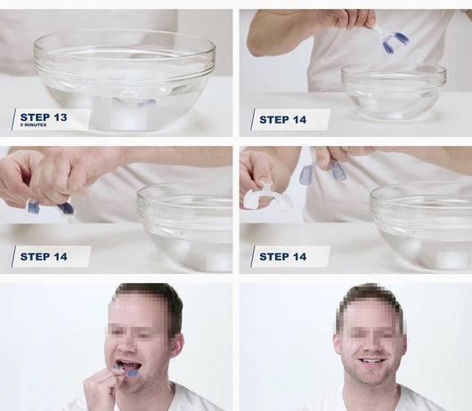 Protector Nocturno para Bruxismo - Férula Dental Cómoda - Image 11