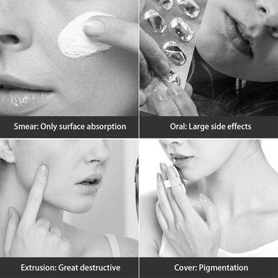 Mascarilla Facial LED de Luz de Colores - Equipo Profesional de Skincare - Image 19