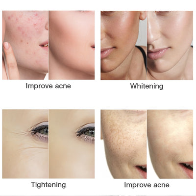 Mascarilla Facial LED de Luz de Colores - Equipo Profesional de Skincare - Image 20