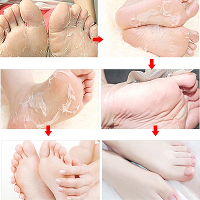 Mascarilla Exfoliante para Pies con Aloe Vera - Calcetines Peladores Regeneradores - Image 12