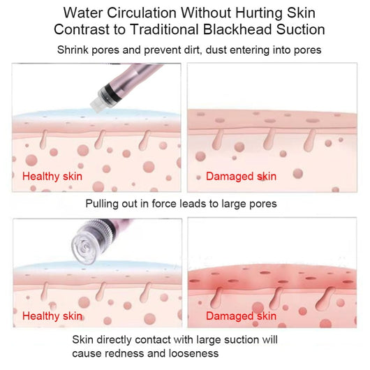 Máquina de Oxígeno e Hidratación con Inyección de Agua para Limpieza Profunda y Rejuvenecimiento Facial - Image 24