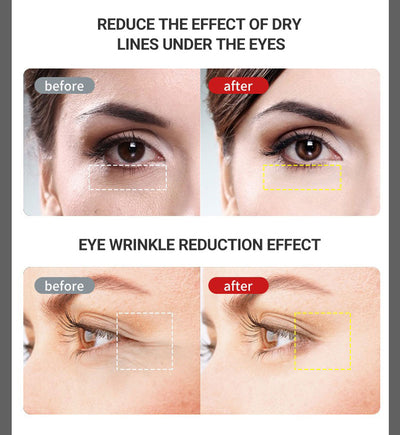 Masajeador Ocular con Microcorriente - Image 16