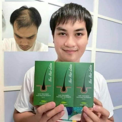 Champú Anticaspa con Reparación y Nutrición Intensiva - Image 12