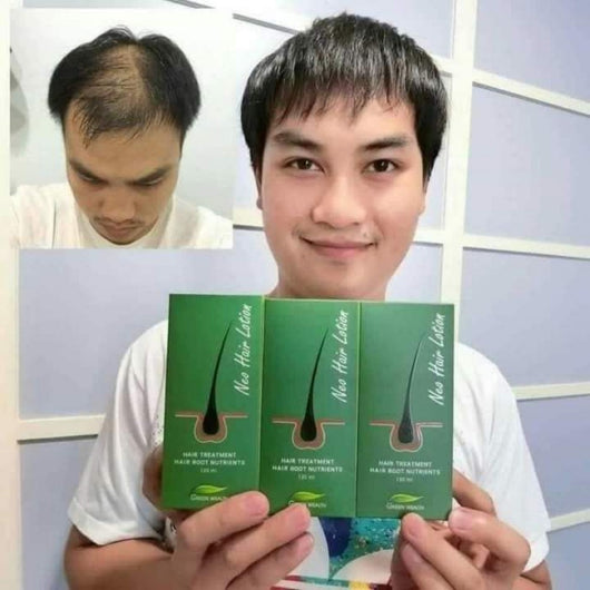 Champú Anticaspa con Reparación y Nutrición Intensiva - Image 12