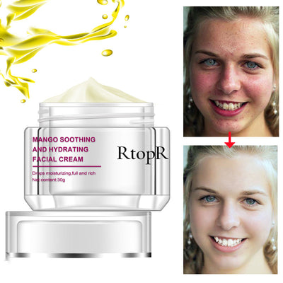 Crema RtopR - Tratamiento Facial Profesional - Image 3