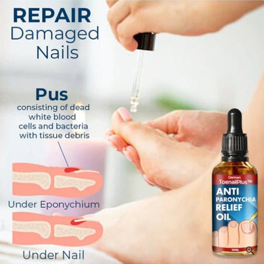 Aceite Reparador de Uñas Engrosado - Tratamiento para Surcos y Grietas