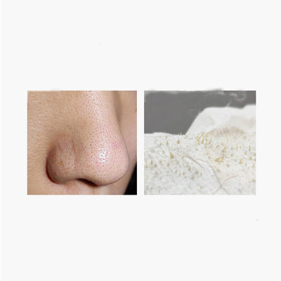 Limpiador Profundo Facial - Eliminador de Puntos Negros y Acné - Image 12