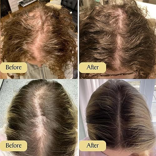 Aceite Esencial Reparador para Cabello Delicado y Suave - Image 2