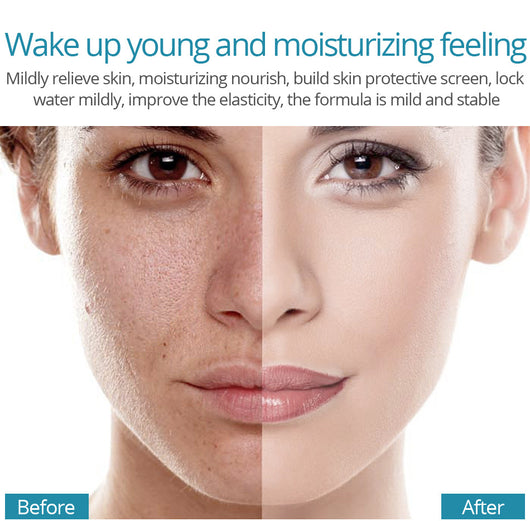 Suero Facial de Ácido Hialurónico - Image 11