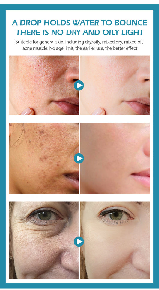 Suero Facial de Ácido Hialurónico - Image 14
