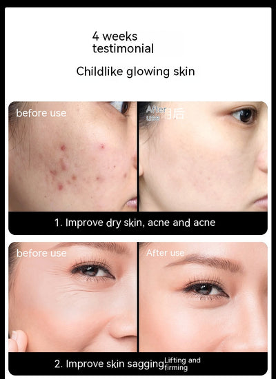 Dispositivo de Radiofrecuencia Pulse RF para Belleza - Image 19