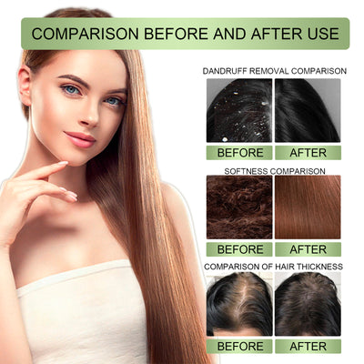 Aceite Capilar Denso Herbal Reparador - Anticaída y Cuero Cabelludo Fortalecido - Image 11